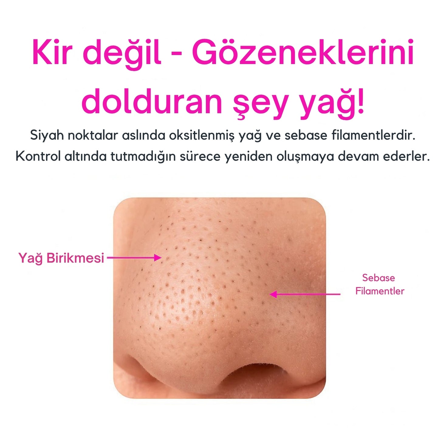 Dermatech PoreLift Gözenek Sıkılaştırıcı & Siyah Nokta Temizleyici Cihaz