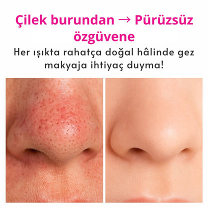 Dermatech PoreLift Gözenek Sıkılaştırıcı & Siyah Nokta Temizleyici Cihaz