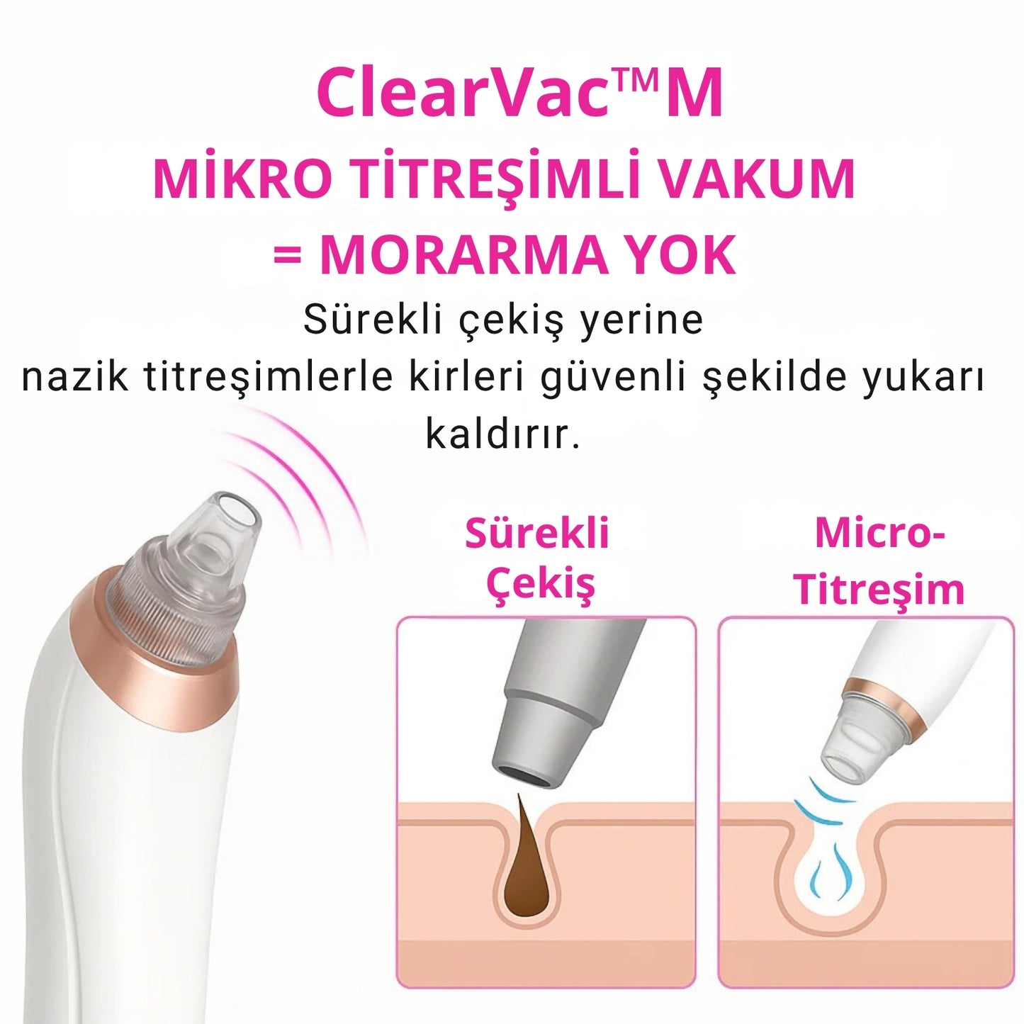Dermatech PoreLift Gözenek Sıkılaştırıcı & Siyah Nokta Temizleyici Cihaz