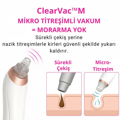 Dermatech PoreLift Gözenek Sıkılaştırıcı & Siyah Nokta Temizleyici Cihaz