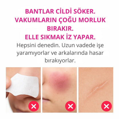 Dermatech PoreLift Gözenek Sıkılaştırıcı & Siyah Nokta Temizleyici Cihaz